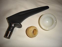 250px-Hip_prosthesis.jpg